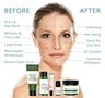 the ordinary skincare